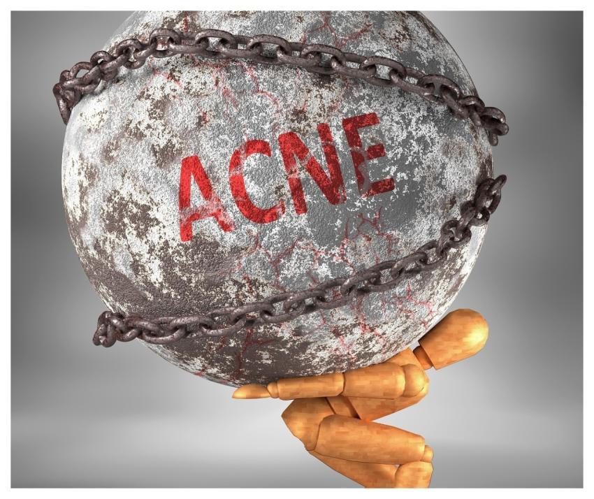 Acne Life Demolish Symbolism