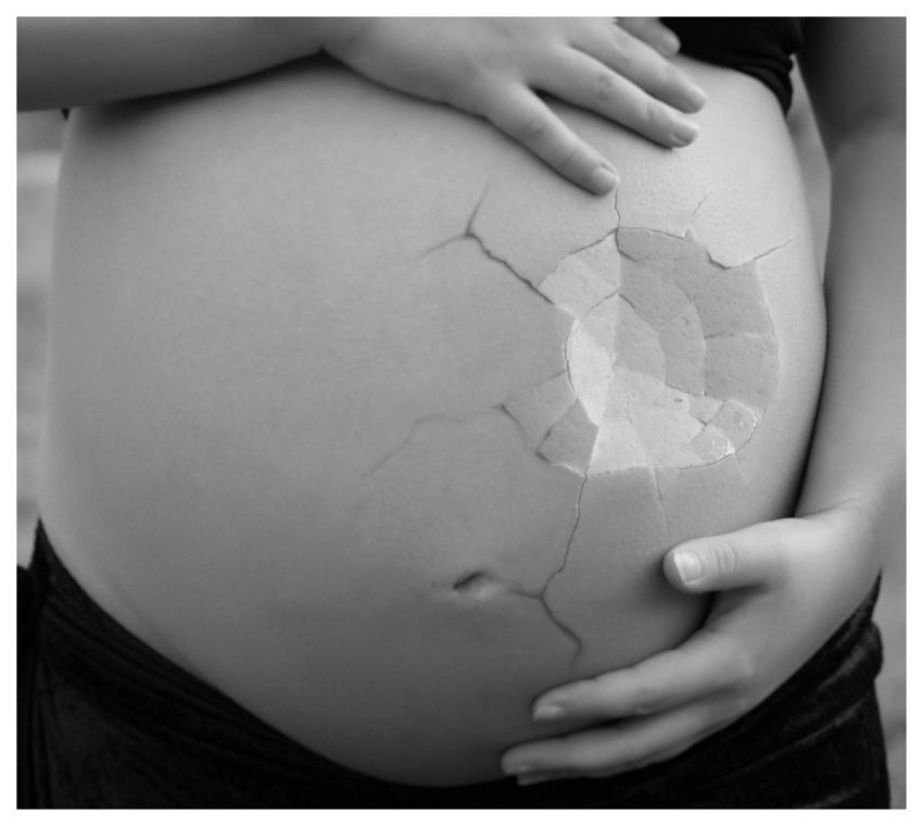 Pregnant Girl Stomach Broken
