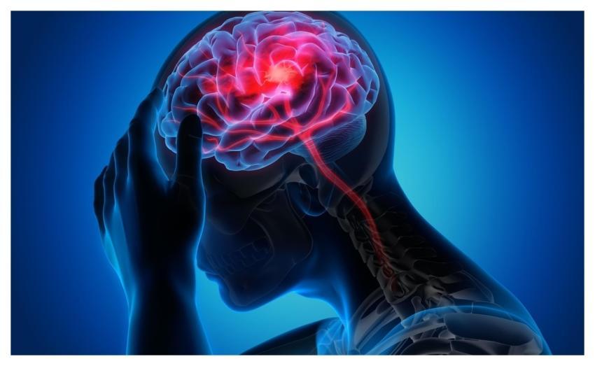 Man Woman Migraine Healthcare