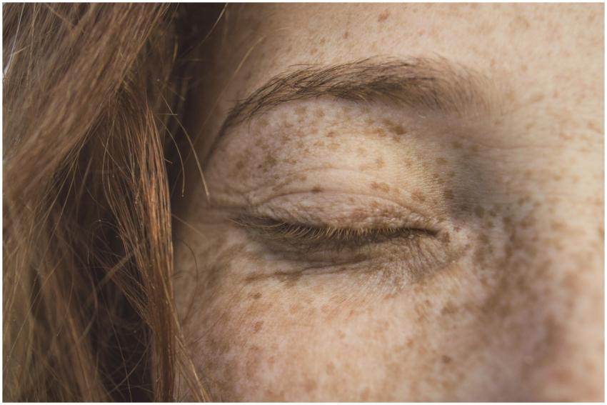 Detailed close-up of a person's freckled skin with
