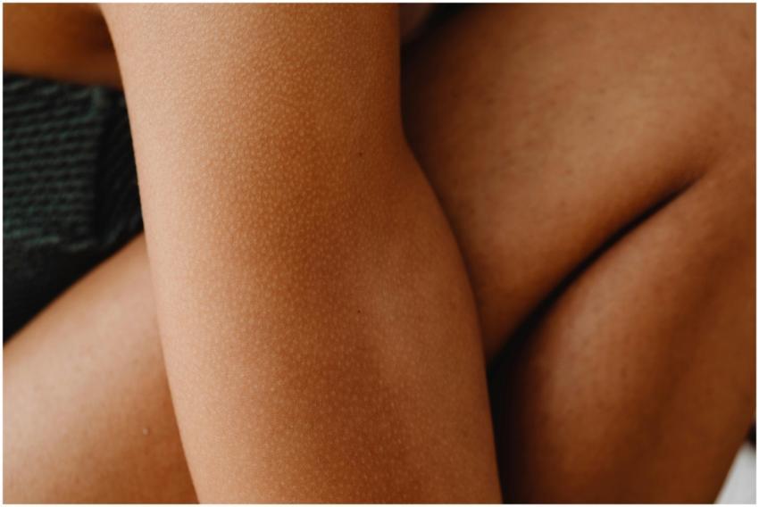 Detailed close-up of human skin with goosebumps, e