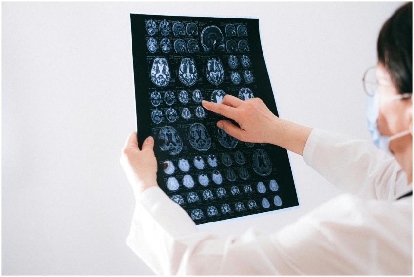 Doctor examines brain MRI scans closely for medica