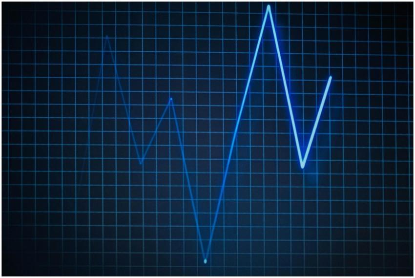 ECG graph on a grid background symbolizing heartbe