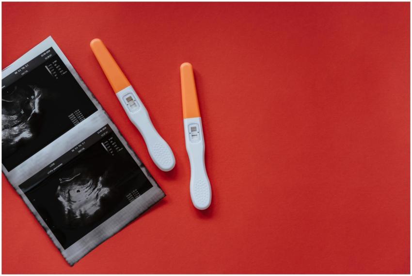 A flat lay of two pregnancy tests and ultrasound i
