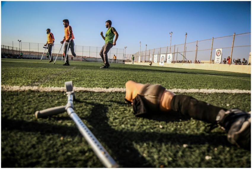 Amputee soccer players practice on a sunny field w