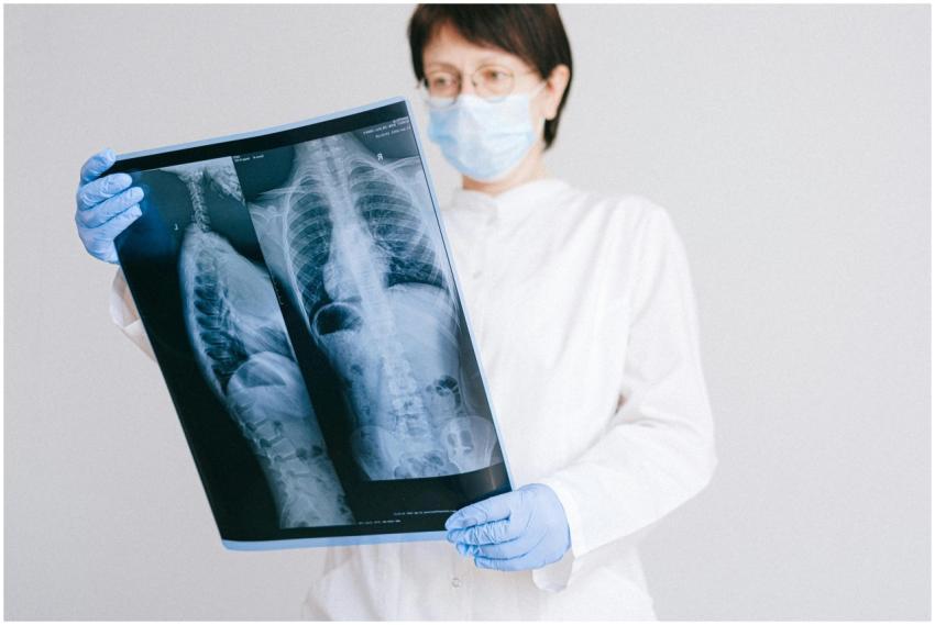 Doctor reviewing X-ray wearing protective gear in