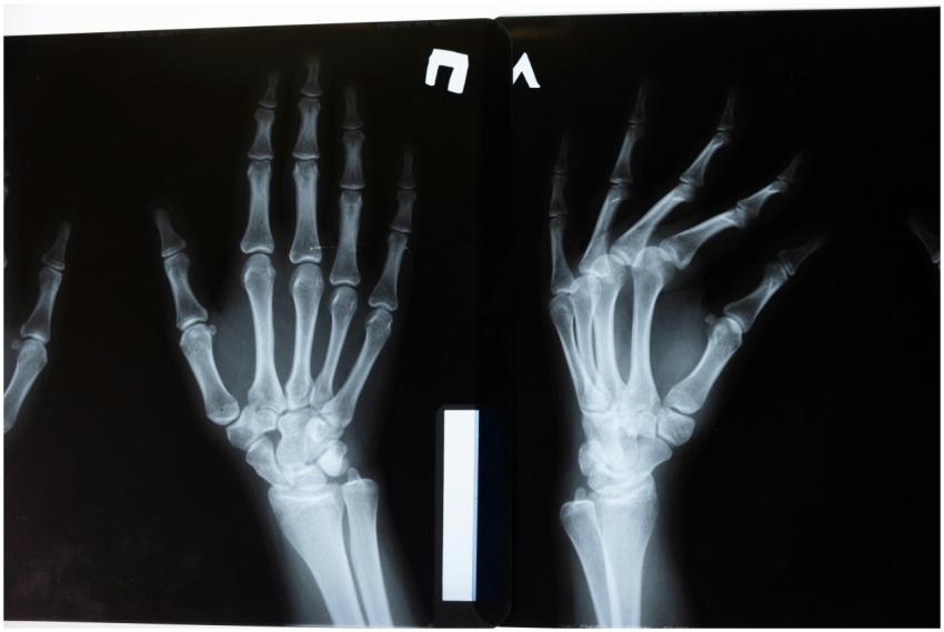 High-resolution x-ray image showing the intricate