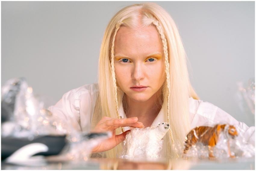 Portrait of a young woman with albinism engaging w