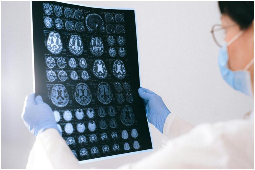 A medical professional reviewing MRI brain scans i