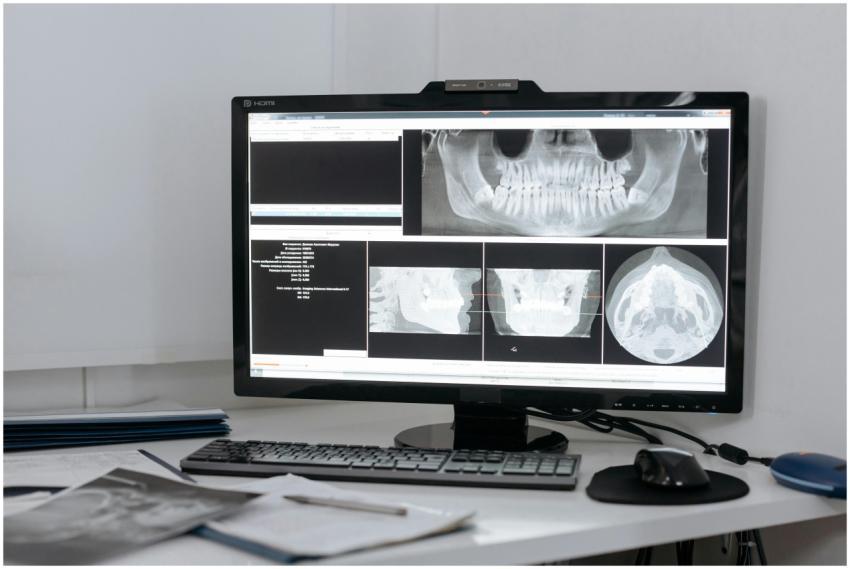 Monitor displaying dental X-ray images in a clinic