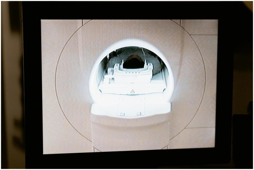 Close-up of an MRI scanner displayed on a monitor