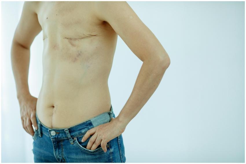 Crop anonymous topless female with scars on breast