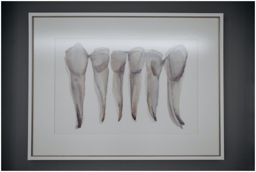 Artistic depiction of extracted teeth framed and d