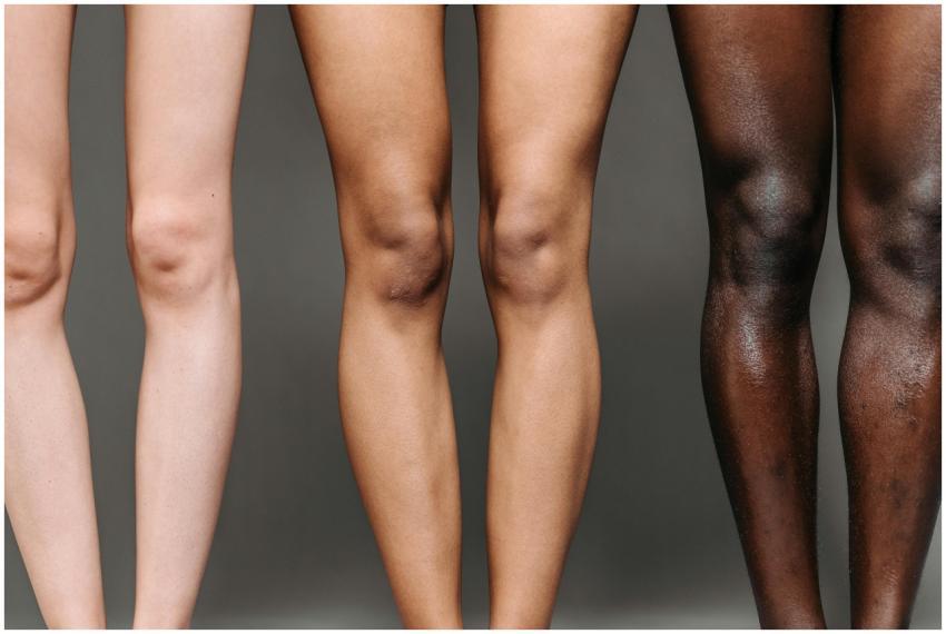 Close-up of diverse women's legs showcasing differ