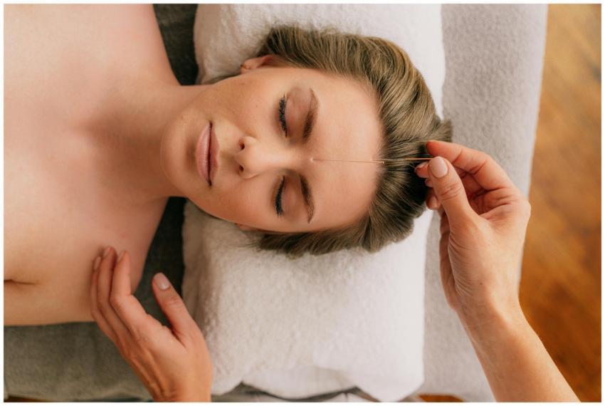 Serene acupuncture treatment focusing on relaxatio
