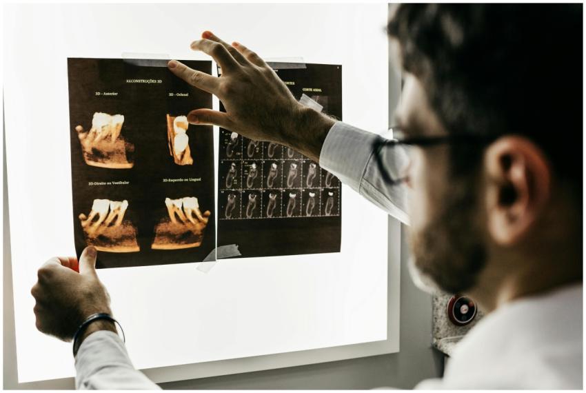 Dentist analyzing dental x-rays to assess patient