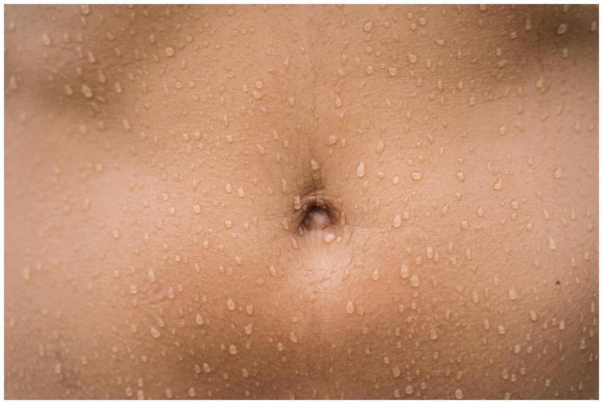 A detailed close-up image of a human belly with wa