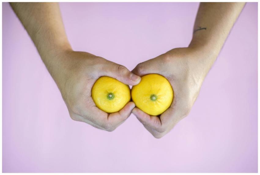 Creative concept with hands holding two lemons aga