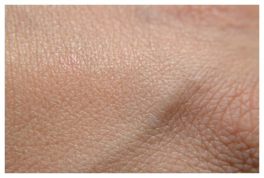 Skin Hand Health Camera