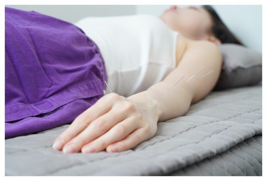 Traditional Medicine Korean Medicine Acupuncture P