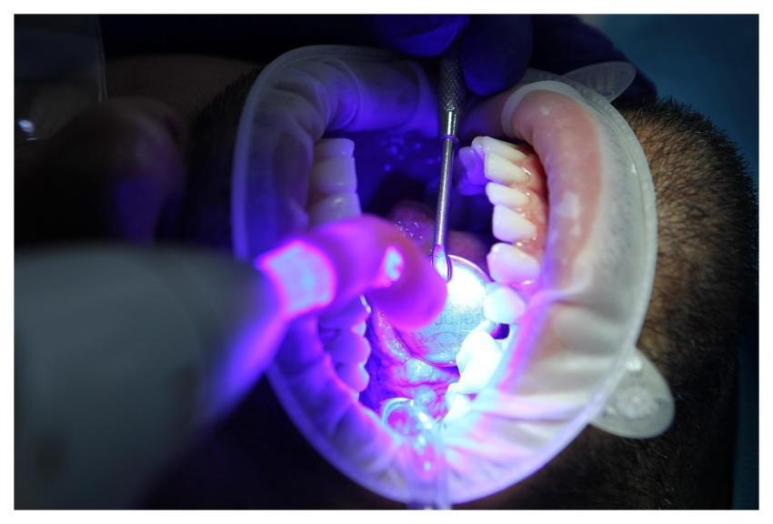 Dentist Oral Health Dental Health Oral Hygiene