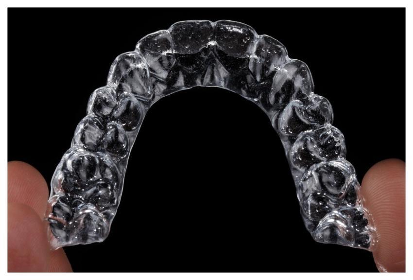 Aligner Invisible Aligner Orthodontics Invisalign