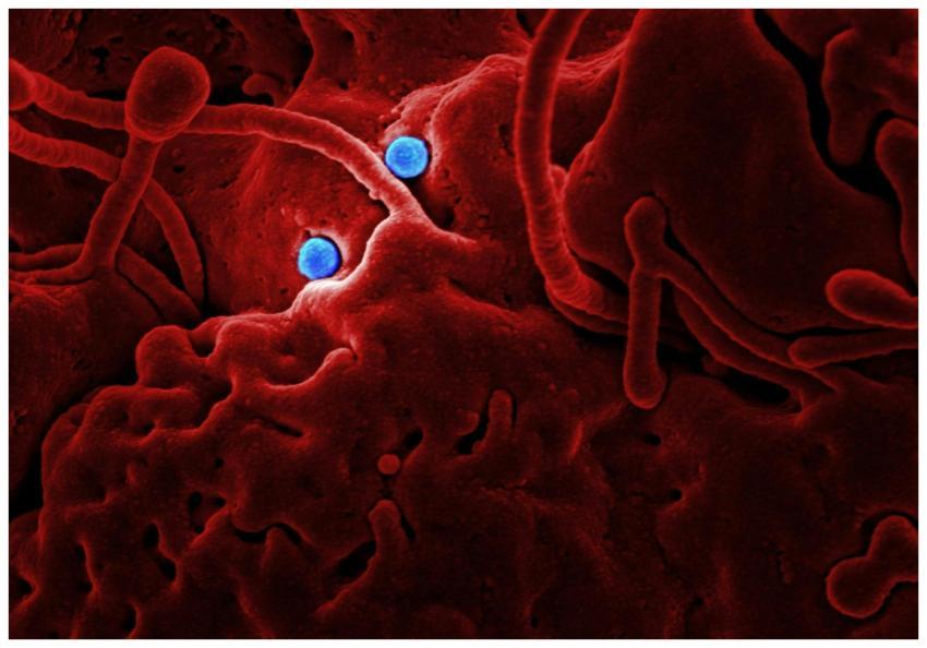 Detailed microscopic image showing red structures