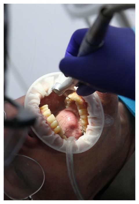 Dentist Oral Health Dental Health Oral Hygiene