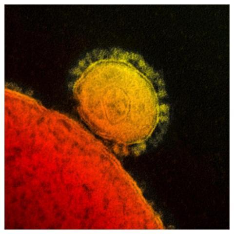 Magnified respiratory syndrome coronavirus. Origin