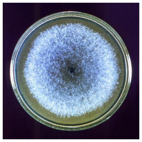 A Petri dish culture plate containing a growth med