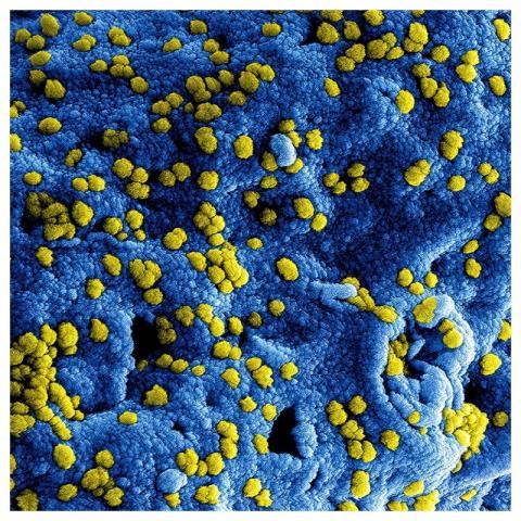 Magnified respiratory syndrome coronavirus. Origin