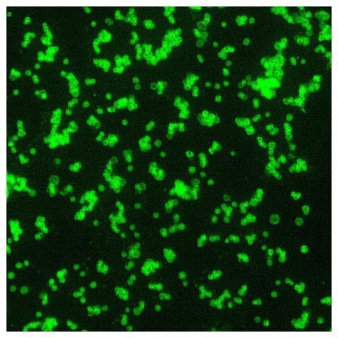 A 1000X photomicrograph magnification of a direct