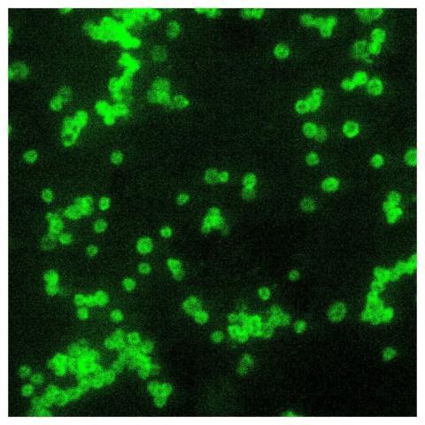 A photomicrograph of a direct fluorescent antibody