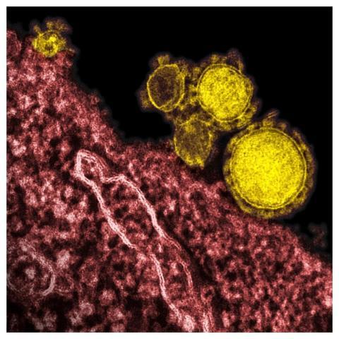 Magnified respiratory syndrome coronavirus. Origin