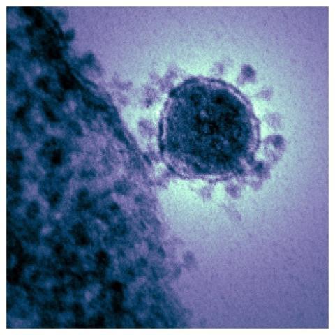 Magnified respiratory syndrome coronavirus. Origin