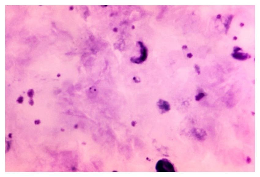 A 1125X photomicrograph magnification of Giemsa st