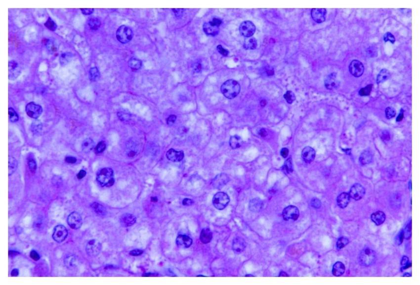 A 440X photomicrograph magnification of a hematoxy
