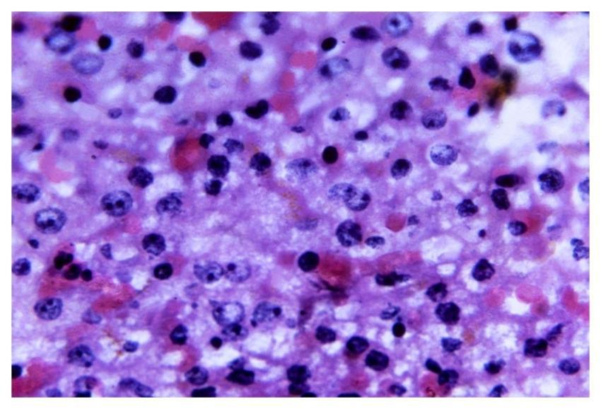 A 440X photomicrograph magnification of a hematoxy