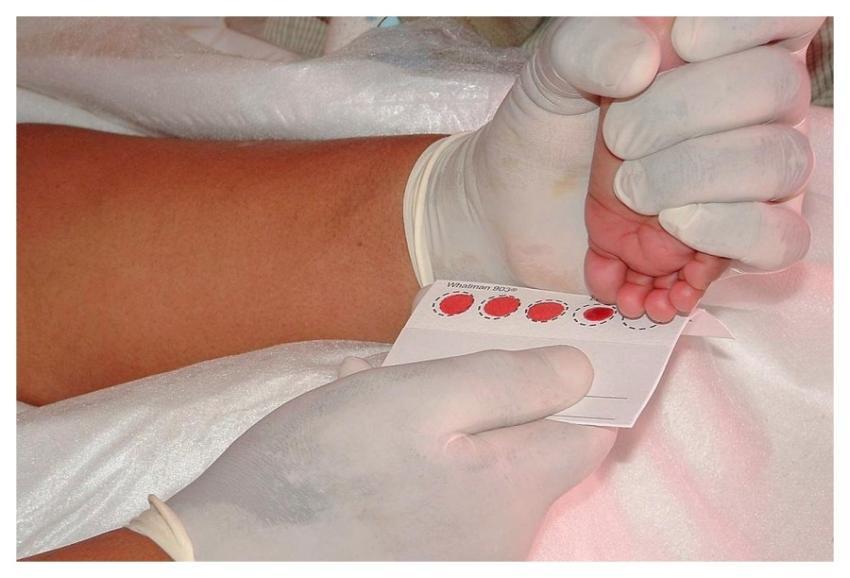 A healthcare worker extracting a blood sample from