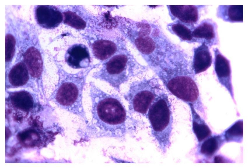 Photomicrograph of Giemsa stained lung tissue. Ori