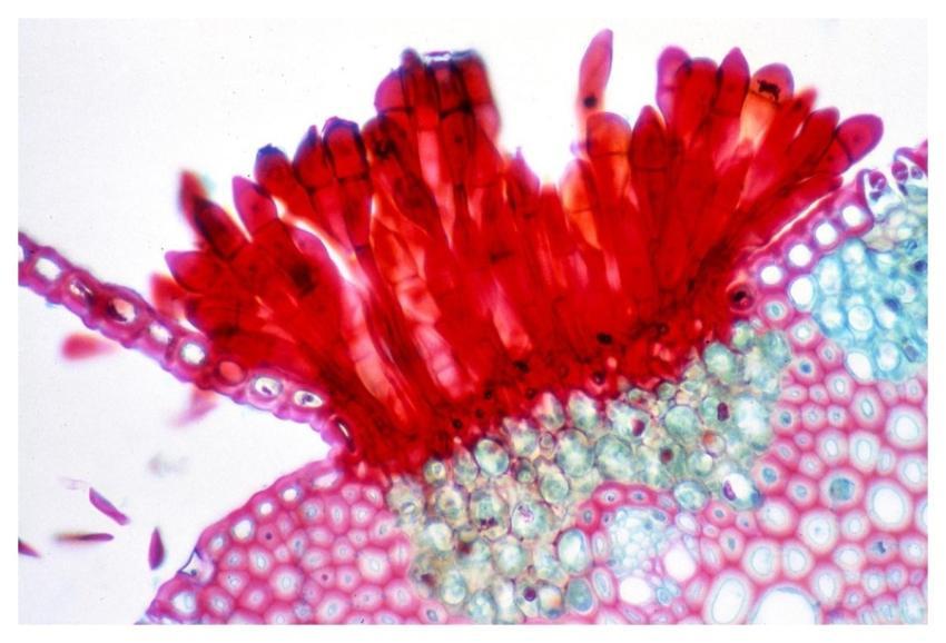 A 100X photomicrograph magnification of histopatho