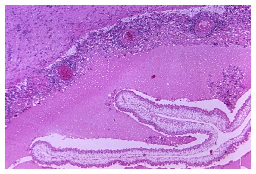 Photomicrograph of a brain tissue specimen. Origin