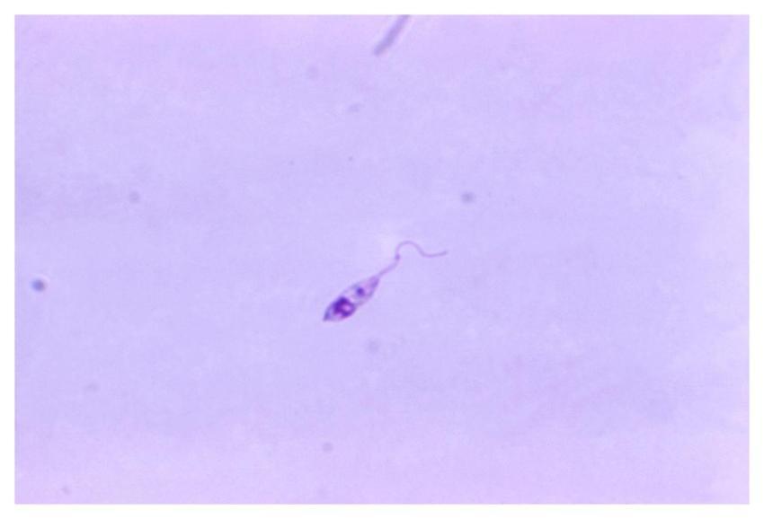 Photomicrograph of a parasite. Original image sour