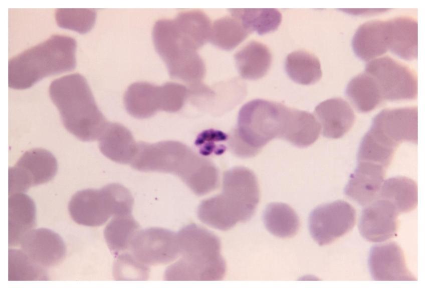 A 1125X photomicrograph magnification of a Giemsa