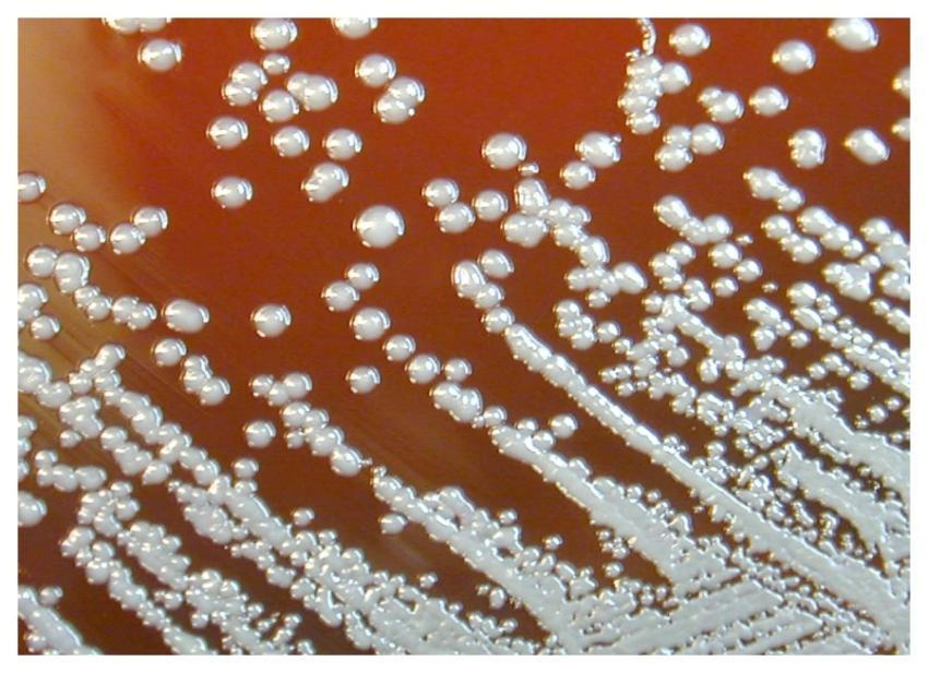 A close view of a Petri dish culture plate, which