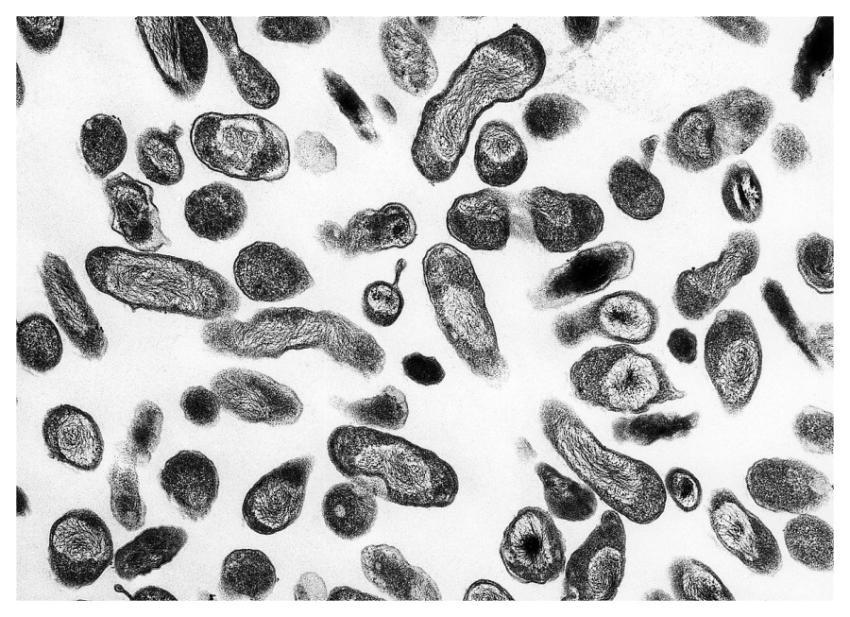Transmission electron microscopic (TEM) image, rev