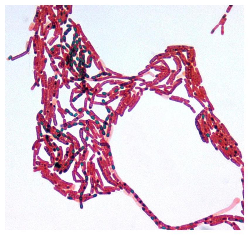 A 100X photomicrograph magnification of a malachit