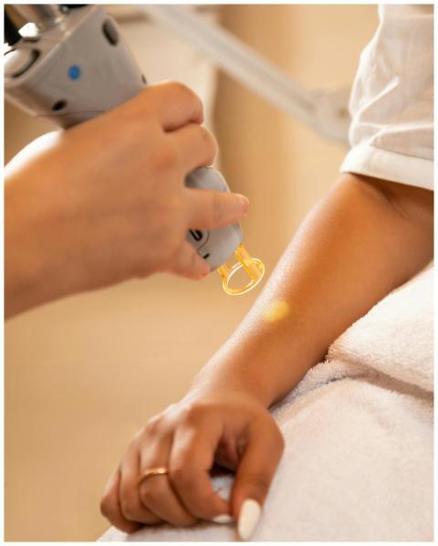 Close-up of a laser hair removal session at a spa,