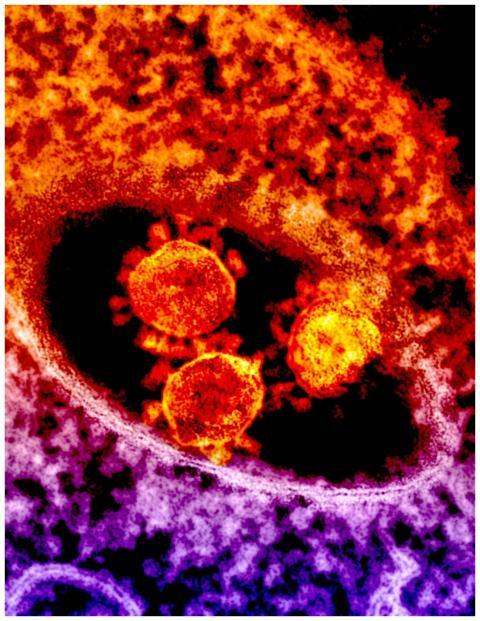 Colorful microscopic image depicting coronavirus p