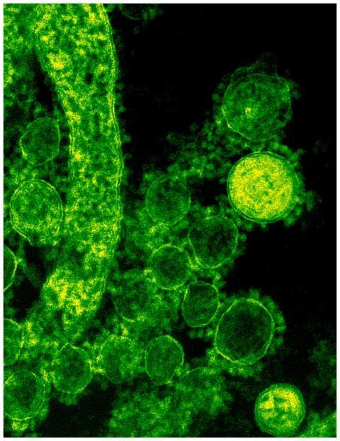 Green-tinted microscopic image of coronavirus part
